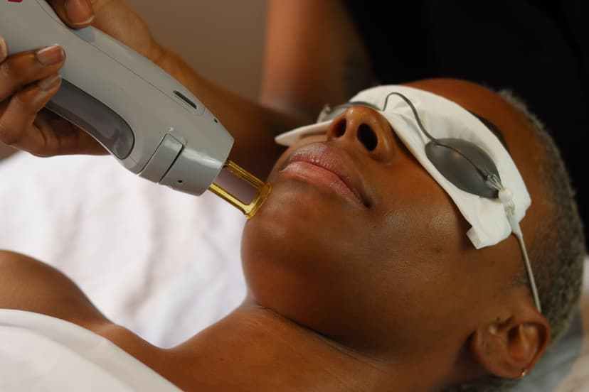 Safe Lasers and Skin Treatments for Dark Skin (Fitzpatrick IV-VI)