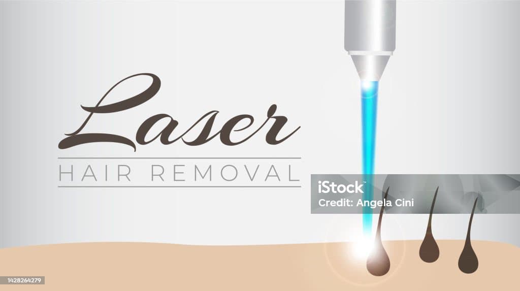 Laser Hair Removal: Complete Patient Guide for 2026
