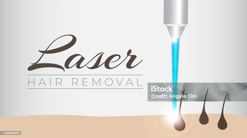 Laser Hair Removal: Complete Patient Guide for 2026
