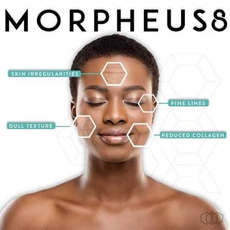 Morpheus8 in Colorado: Costs, Clinics & What Patients Need to Know (2026)
